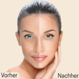 Naiora Perfect Cover Concealer  - mit atmungsaktiver Formel