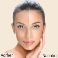 Naiora Perfect Cover Concealer  - mit atmungsaktiver Formel