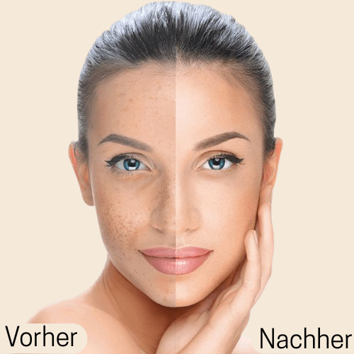 Naiora Perfect Cover Concealer  - mit atmungsaktiver Formel